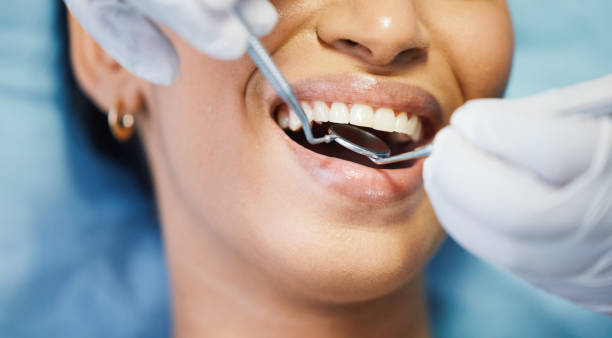 Best Emergency Tooth Extraction in New Baden, IL