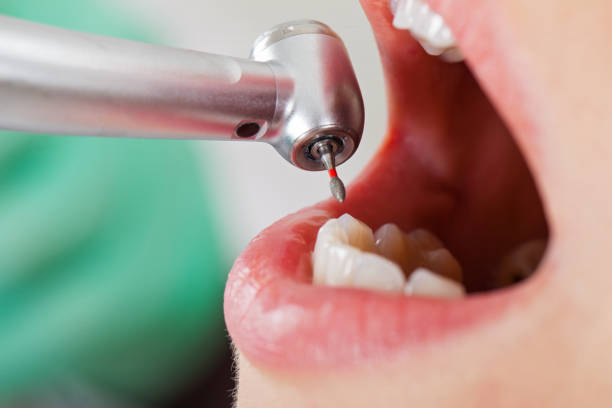 Best Same-Day Emergency Dental Services in New Baden, IL